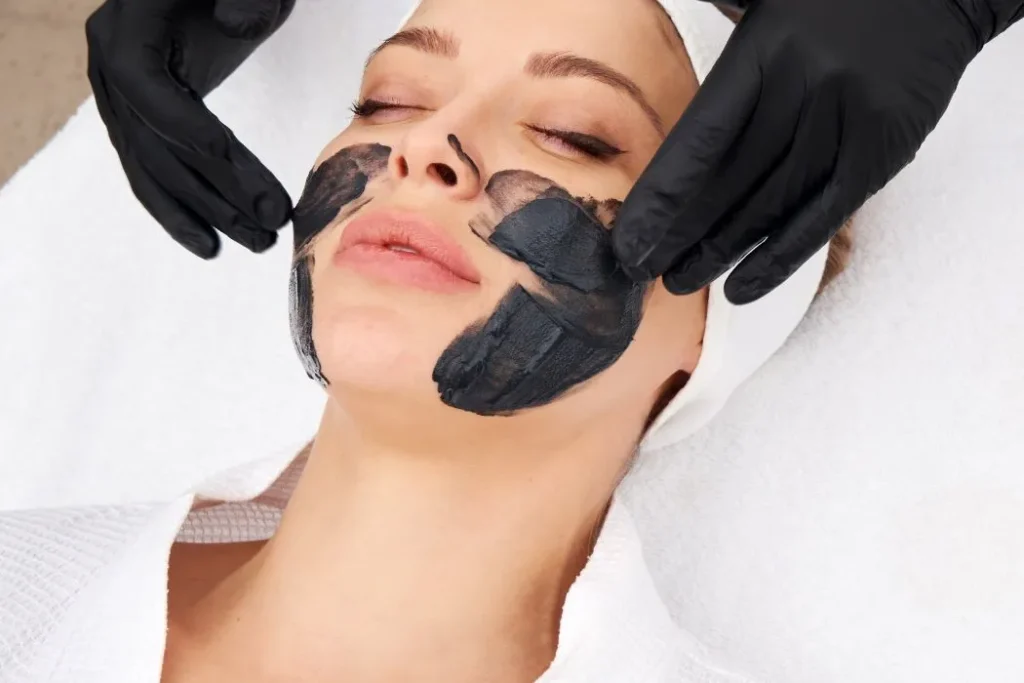 Carbon laser facial treatment